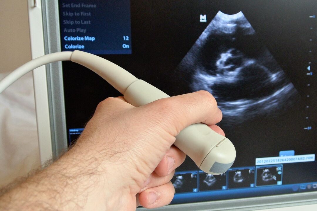Ultrasound helps to diagnose congestive prostatitis in a man
